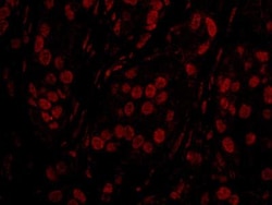TOPORS Antibody, Novus Biologicals 0.1mL; Unlabeled:Antibodies, Polyclonal