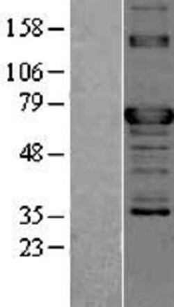 Novus Biologicals&trade;&nbsp;TOR1AIP2 Overexpression Lysate