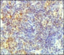 TORC2 Antibody - BSA Free, Novus Biologicals 0.025mL; Unlabeled:Antibodies,
