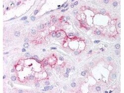 TOR/mTOR, p Ser2448 Antibody, Novus Biologicals 0.1mg; Unlabeled:Antibodies,