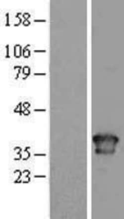 Novus Biologicals&trade;&nbsp;Torsin A Overexpression Lysate