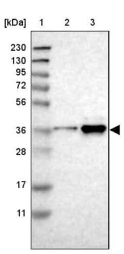 Torsin 1B Antibody, Novus Biologicals 0.1mL; Unlabeled:Antibodies, Polyclonal
