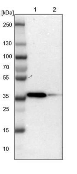 Torsin 1B Antibody, Novus Biologicals 0.1mL; Unlabeled:Antibodies, Polyclonal