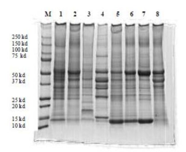 Novus Biologicals Total Protein Extraction Kit 1 Kit; Total Protein ExtractionProtein Fisher