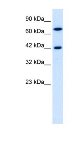 TOX2 Antibody, Novus Biologicals 100 &mu;L | Buy Online | Novus Biologicals | Fisher Scientific