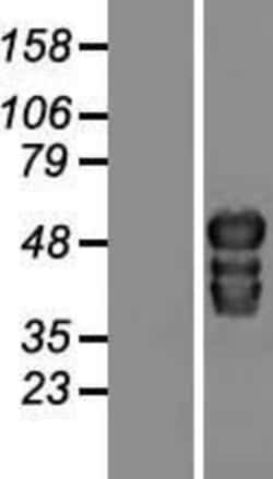 Novus Biologicals&trade;&nbsp;TOX2 Overexpression Lysate