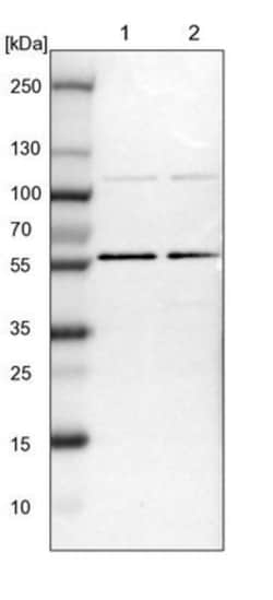 TOX4 Antibody, Novus Biologicals 25 &mu;L | Buy Online | Novus Biologicals | Fisher Scientific