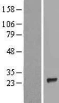 Novus Biologicals™ TP73-AS1 Overexpression Lysate