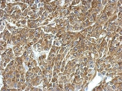 TPD52 Antibody, Novus Biologicals 0.1mL; Unlabeled:Antibodies, Polyclonal
