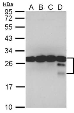 TPD52 Antibody, Novus Biologicals 0.1mL; Unlabeled:Antibodies, Polyclonal