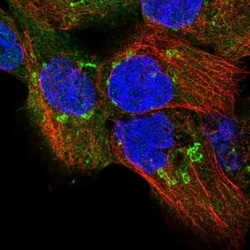 TPD52 Antibody, Novus Biologicals 0.1mL; Unlabeled:Antibodies, Polyclonal