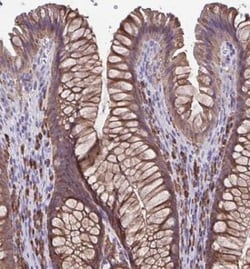 TPD52 Antibody, Novus Biologicals 0.1mL; Unlabeled:Antibodies, Polyclonal