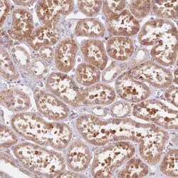 TPD52L2/D54 Antibody, Novus Biologicals 0.1mL; Unlabeled:Antibodies, Polyclonal