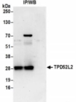 TPD52L2/D54 Antibody, Novus Biologicals 0.1mL:Antibodies, Polyclonal