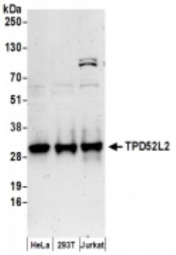 TPD52L2/D54 Antibody, Novus Biologicals 0.1mL:Antibodies, Polyclonal