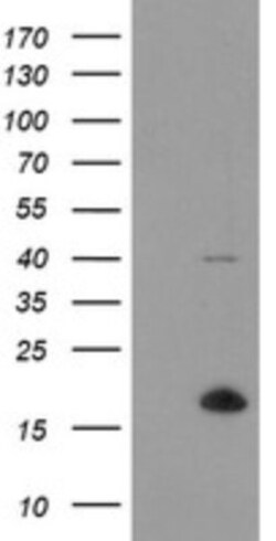 TPD52L3/D55 Antibody (OTI8C12), Novus Biologicals 0.1mL; Unlabeled:Antibodies,