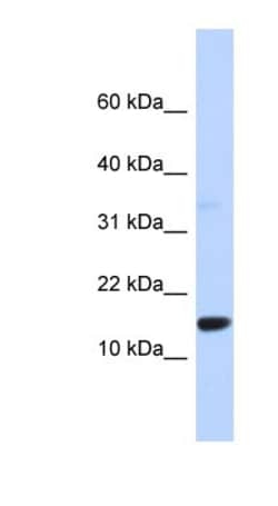 TPD52L3/D55 Antibody, Novus Biologicals 100&mu;L; Unlabeled:Antibodies,