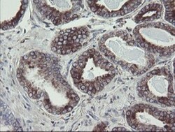 TPD52L3/D55 Antibody (OTI8C12), Novus Biologicals 0.1mL; Unlabeled:Antibodies,