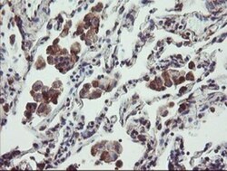 TPD52L3/D55 Antibody (OTI8C12), Novus Biologicals 0.1mL; Unlabeled:Antibodies,