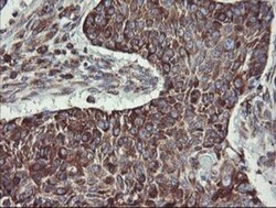 TPD52L3/D55 Antibody (OTI8C12), Novus Biologicals 0.1mL; Unlabeled:Antibodies,