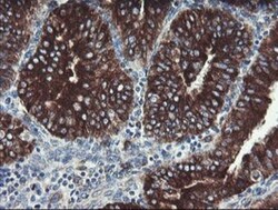 TPD52L3/D55 Antibody (OTI8C12), Novus Biologicals 0.1mL; Unlabeled:Antibodies,