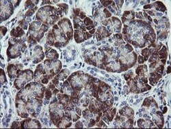 TPD52L3/D55 Antibody (OTI8C12), Novus Biologicals 0.1mL; Unlabeled:Antibodies,