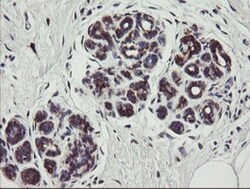 TPD52L3/D55 Antibody (OTI8C12), Novus Biologicals 0.1mL; Unlabeled:Antibodies,