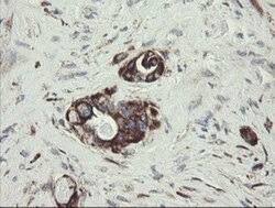 TPD52L3/D55 Antibody (OTI8C12), Novus Biologicals 0.1mL; Unlabeled:Antibodies,