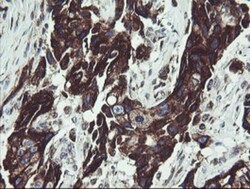 TPD52L3/D55 Antibody (OTI8C12), Novus Biologicals 0.1mL; Unlabeled:Antibodies,