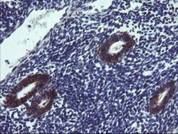 TPD52L3/D55 Antibody (OTI8C12), Novus Biologicals 0.1mL; Unlabeled:Antibodies,