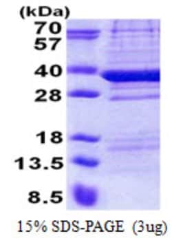 Novus Biologicals&trade;&nbsp;Recombinant Human TPGS2 His Protein