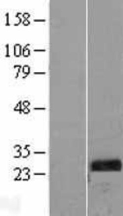 Novus Biologicals™ TPK1 Overexpression Lysate