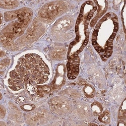 T Plastin Antibody, Novus Biologicals:Antibodies:Primary Antibodies