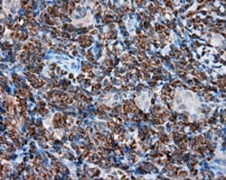TPMT Antibody (OTI2A2), Novus Biologicals 0.1mL; Unlabeled:Antibodies,
