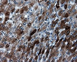 TPMT Antibody (OTI2A2), Novus Biologicals 0.1mL; Unlabeled:Antibodies,