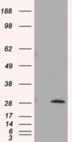 TPMT Antibody (OTI2A2), Novus Biologicals 0.1mL; Unlabeled:Antibodies,