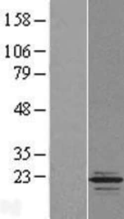 Novus Biologicals™ TPPP2 Overexpression Lysate