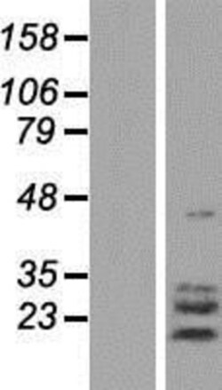 Novus Biologicals™ TPPP3 Overexpression Lysate