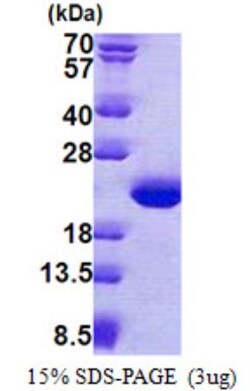 Novus Biologicals&trade;&nbsp;Recombinant Human TPPP3 His Protein