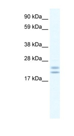 TPPP/p25 Antibody, Novus Biologicals 100 &mu;L | Buy Online | Novus Biologicals | Fisher Scientific