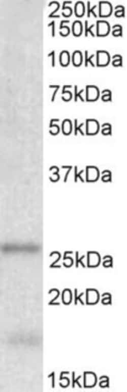 TPPP/p25 Antibody, Novus Biologicals 0.1mg; Unlabeled:Antibodies, Polyclonal