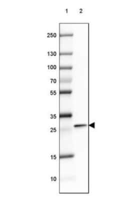 TPPP/p25 Antibody, Novus Biologicals:Antibodies:Primary Antibodies
