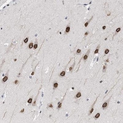 TPR Antibody, Novus Biologicals:Antibodies:Primary Antibodies