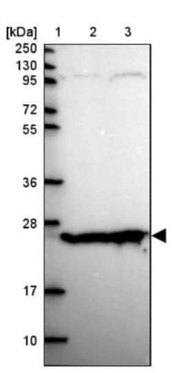 TPRG1 Antibody, Novus Biologicals 25 &mu;L, Unlabeled:Antibodies, Polyclonal