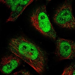 TPRG1 Antibody, Novus Biologicals 25 &mu;L, Unlabeled:Antibodies, Polyclonal