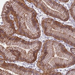 TPRG1 Antibody, Novus Biologicals 25 &mu;L, Unlabeled:Antibodies, Polyclonal