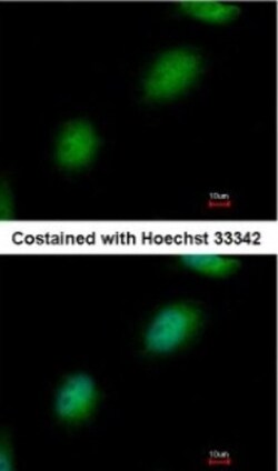 TPRKB Antibody, Novus Biologicals 0.1mg; Unlabeled:Antibodies, Polyclonal