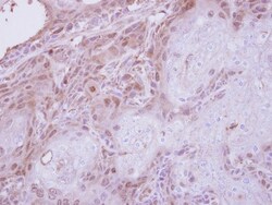 TPRKB Antibody, Novus Biologicals 0.1mg; Unlabeled:Antibodies, Polyclonal
