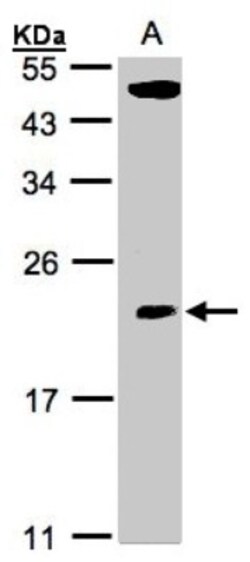 TPRKB Antibody, Novus Biologicals 0.1mg; Unlabeled:Antibodies, Polyclonal