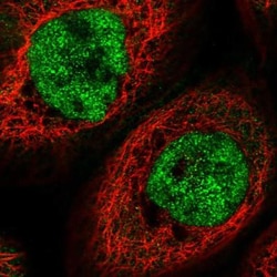 anti-TPRX1, Polyclonal, Novus Biologicals 0.1mL; Unlabeled:Antibodies,